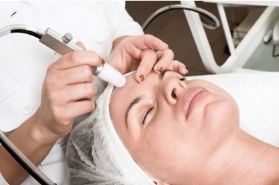Microdermabrasion